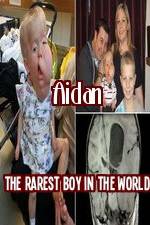 Watch Aidan The Rarest Boy In The World Sockshare