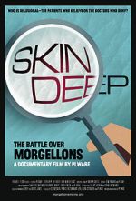 Watch Skin Deep: The Battle Over Morgellons Sockshare