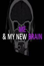 Watch Me & My New Brain Sockshare