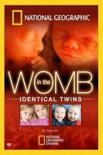 Watch National Geographic: In the Womb - Identical Twins Sockshare