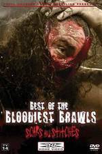 Watch TNA Wrestling: Best of the Bloodiest Brawls - Scars and Stitches Sockshare