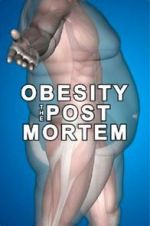 Watch Obesity: The Post Mortem Sockshare