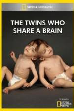 Watch National Geographic The Twins Who Share A Brain Sockshare