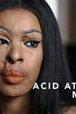 Watch Acid Attack: My Story Sockshare