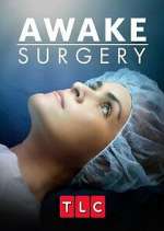 Watch Awake Surgery Sockshare