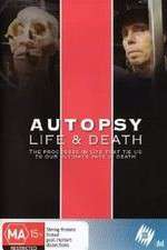 Watch Autopsy: Life and Death Sockshare