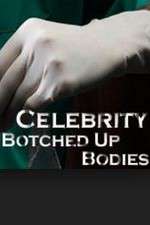 Watch Celebrity Botched Up Bodies Sockshare